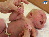 Úchopový reflex na horních končetinách novorozence