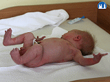 Moroův reflex novorozence, fáze I