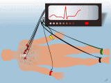 Elektrokardiografické vyšetření - EKG