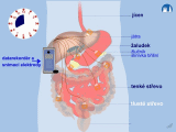 Gastrointestinální trakt – endoskopie kapslová