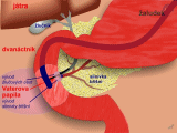 Gastrointestinální trakt - Endoskopická retrográdní cholangiopankreatografie