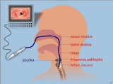 Dýchací cesty - laryngoskopie