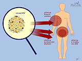 Způsob nákazy HIV