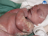 Mázek na kůži novorozence