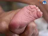Rýhování plosek nohou u novorozence