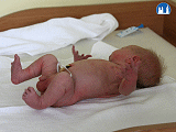 Moroův reflex novorozence,fáze II