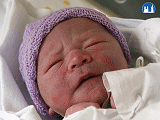 Stagnační cyanóza novorozence