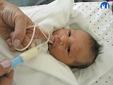 Krmení novorozence cévkou po prstu