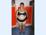 Obezita II. stupně, BMI 39
