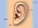 Zevní ucho