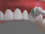 Čištění zubů elektrickým zubním kartáčkem