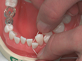 Čištění mezizubních prostor zubní nití